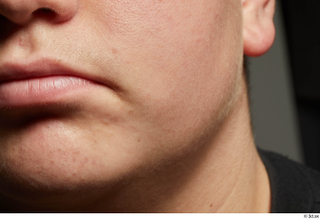  HD Face skin references Abraham Hurtado cheek lips mouth nose skin pores skin texture 0005.jpg